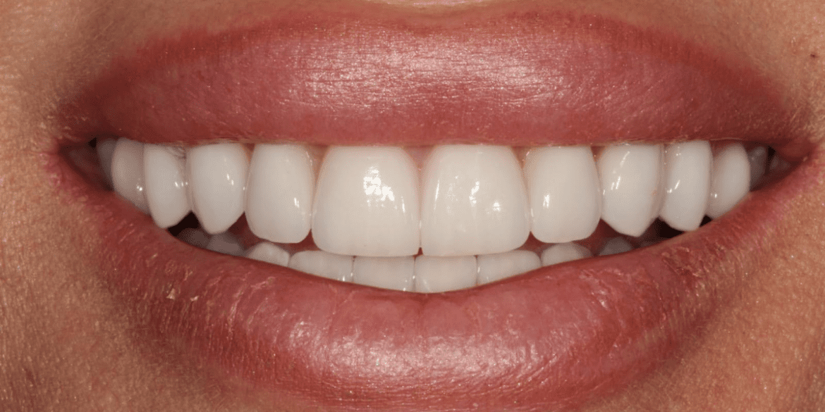 Dn image (1200 x 600 px)